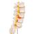 Human Lumbar Spinal Column Model with Dorso-Lateral Prolapsed Intervertebral Disc, 1000150 [A76/5], Vertebra Models (Small)