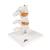 Deluxe Human Osteoporosis Model (3 Vertebrae with Discs ), Removable on Stand, 1000153 [A78], Vertebra Models (Small)