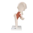 엉덩이 관절(고관절) 모형 Functional Hip Joint, 1000161 [A81], 관절 모형