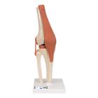 Functional Human Knee Joint Model with Ligaments & Marked Cartilage, 1000164 [A82/1], Joint Models