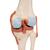 Functional Human Knee Joint Model with Ligaments & Marked Cartilage, 1000164 [A82/1], Joint Models (Small)