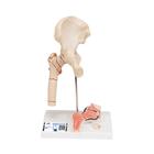 Human Femoral Fracture & Hip Osteoarthritis Model, 1000175 [A88], Joint Models