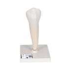 Lower Single-Root Pre-Molar Human Tooth Model - 3B Smart Anatomy, 1000242 [D10/3], Replacements