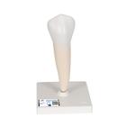 Lower Single-Root Pre-Molar Human Tooth Model, 1000242 [D10/3], Dental Models