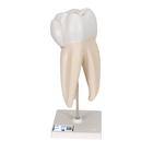 Zahnmodell Oberer Dreiwurzeliger Molar, 3-teilig, 1017580 [D10/5], Zahnmodelle