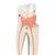 Upper Triple-Root Molar Human Tooth Model, 3 part, 1017580 [D10/5], Dental Models (Small)