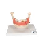 치아 질환 모형 Dental disease, magnified 2 times, 21 parts, 1000016 [D26], 치아 모형