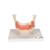 Dental Disease Model, Magnified 2 times, 21 parts, 1000016 [D26], Dental Models (Small)