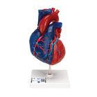 심장 모형 Life-Size Human Heart Model, 5 parts, 1010007 [G01/1], 심장 및 순환기 모형