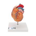 Classic Human Heart Model with Left Ventricular Hypertrophy (LVH), 2 part, 1000261 [G04], Human Heart Models