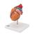 Classic Human Heart Model with Left Ventricular Hypertrophy (LVH), 2 part, 1000261 [G04], Human Heart Models (Small)