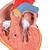 Classic Human Heart Model with Left Ventricular Hypertrophy (LVH), 2 part, 1000261 [G04], Human Heart Models (Small)