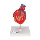 Классическая модель сердца с шунтом, 2 части - 3B Smart Anatomy, 1017837 [G05], Здоровое сердце и фитнес