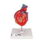 관상동맥 우회술 심장 모형 (2파트) Classic Human Heart Model with Bypass, 2 part, 1017837 [G05], 심장 및 순환기 모형