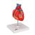 Cuore, modello classico, con bypass, in 2 parti, 1017837 [G05], Strumenti didattici cardiaci e di cardiofitness (Small)