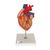 Cuore con bypass, ingrandito 2 volte, in 4 parti, 1000263 [G06], Modelli di Cuore e Apparato Circolatorio (Small)