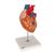 Human Heart Model with Bypass, 2 times Life-Size, 4 part, 1000263 [G06], Human Heart Models (Small)