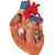 Human Heart Model with Bypass, 2 times Life-Size, 4 part, 1000263 [G06], Human Heart Models (Small)