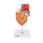 식도와 기관을 포함한 심장모형 실물 크기 2배 5 파트 분리  Heart with Esophagus and Trachea, 2 times life size, 5 part, 1000269 [G13], 심장 및 순환기 모형