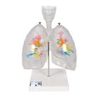 CT - Arbre bronchique avec larynx et poumon transparent, 1000275 [G23/1], Modèles de poumons