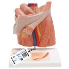 서혜부 탈장 모형

Inguinal Hernia Model, 1000284 [H13], 생식기 및 골반 모델