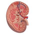 Basic Kidney Section Model, 3 times Full-Size, 1000295 [K09], Urology Models