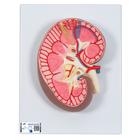 Kidney Section Model, 3 times Full-Size, 1000296 [K10], Urology Models