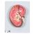 Kidney Section Model, 3 times Full-Size, 1000296 [K10], Urology Models (Small)