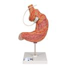 Human Stomach Model with Gastric Band, 2 part, 1012787 [K15/1], Digestive System Models