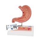 Human Stomach Section Model with Ulcers, 1000304 [K17], Digestive System Models