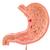 Human Stomach Section Model with Ulcers, 1000304 [K17], Digestive System Models (Small)