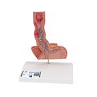 Life-Size Human Esophagus Diseases Model, 1000305 [K18], Digestive System Models