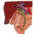 Gallstone Model, 1000314 [K26], Digestive System Models (Small)