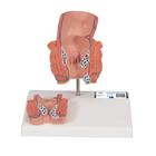 Hemorrhoid Model, 1000315 [K27], Digestive System Models