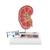 Kidney Stone Model, 1000316 [K29], Urology Models (Small)