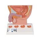 Prostate Model, 1/2 Natural Size, 1000319 [K41], Urology Models