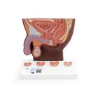 Prostate Model, 1/2 Natural Size, dark skin, 1024384 [K41D], Health Education