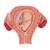 Fetus Modell, 3. Monat, 1000324 [L10/3], Mensch (Small)