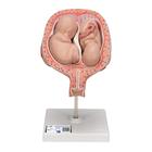 Модель 5-месячных плодов близнецов, нормальное положение - 3B Smart Anatomy, 1000328 [L10/7], Модели по оплодотворению и эмбриональному развитию человека