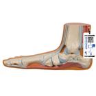 Flat Foot (Pes Planus) Model, 1000355 [M31], Joint Models