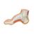 오목발(요족) Hollow Foot (Pes Cavus) Model, 1000356 [M32], 관절 모형 (Small)