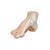 오목발(요족) Hollow Foot (Pes Cavus) Model, 1000356 [M32], 관절 모형 (Small)