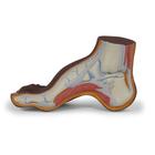 Hollow Foot (Pes Cavus) Model, dark skin - 3B Smart Anatomy, 1024389 [M32D], Joint Models