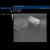 SONOtrain Breast Model with Cysts dark skin, 1024722 [P124D], Ultrasound Skill Trainers (Small)