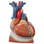 Heart and Diaphragm Model, 3 times Life-Size, 10 part, 1008547 [VD251], Human Heart Models