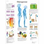 Osteoporose, 1001306 [VR0121L], Informações sobre artrite e osteoporose