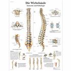 Die menschliche Wirbelsäule - Anatomie und Pathologie, 1001314 [VR0152L], Плакаты по опорно-двигательному аппарату человека