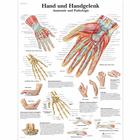 Hand und Handgelenk - Anatomie und Pathologie, 1001318 [VR0171L], Плакаты по опорно-двигательному аппарату человека