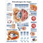 Erkrankungen des Auges, 1001332 [VR0231L], Плакаты по глазам (офтальмология)