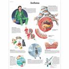 Asthma, 1001354 [VR0328L], Обучение по вопросам бронхиальной астмы и аллергии